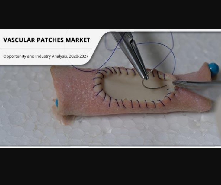 vascular patches market