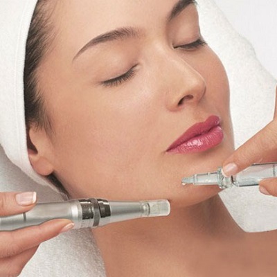 Unlocking the Secrets of Dermapen Therapy for Flawless Skin